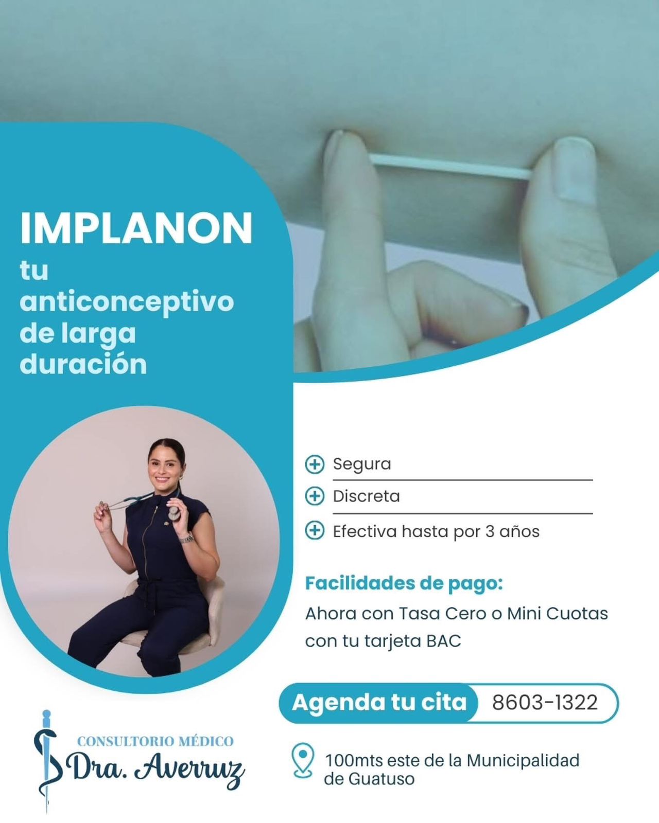 Implanon completo